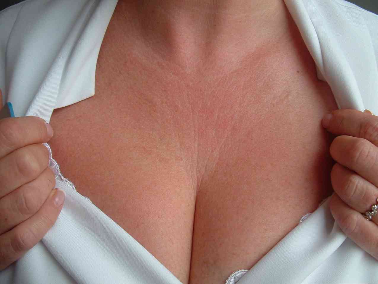 Обривът на гърдите е ясен знак, който позволява на лекаря